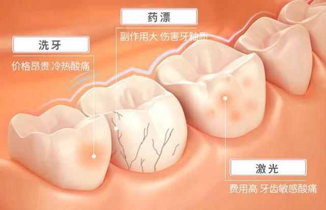 关于7个月宝宝口臭的问题分析及对策建议